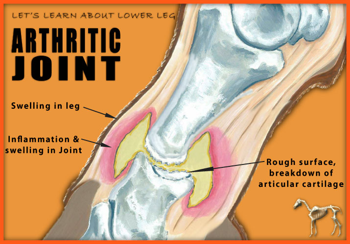 Arthritic Joint image