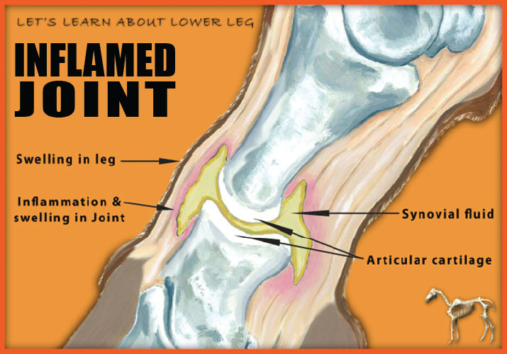 Inflammed Joint image